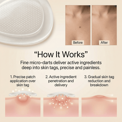 DermaSmooth - Tag & Mole Remover (Buy 1 Get 1 Free)