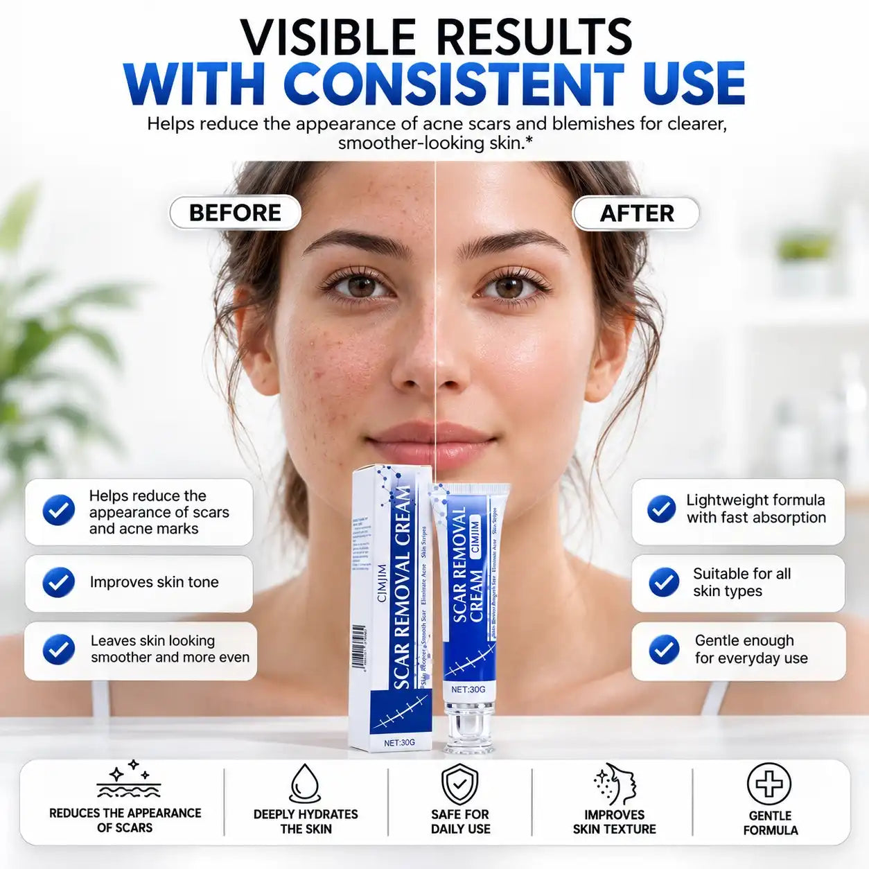 ScarSmooth™- Great for all types of marks AB