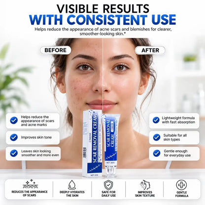 ScarSmooth™- Great for all types of marks AB