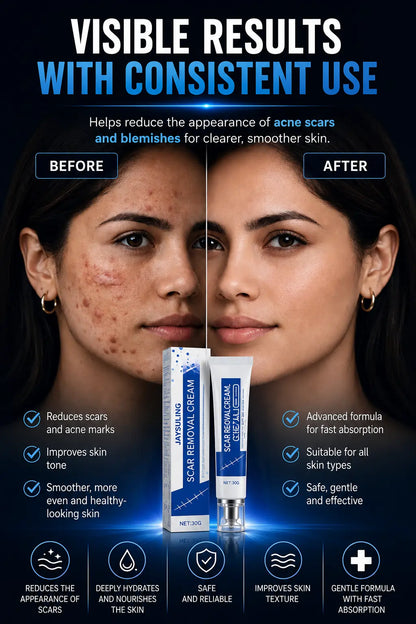 ScarSmooth™- Great for all types of marks